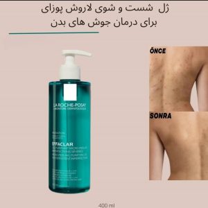 ژل لایه بردار میکروپیلینگ افکلار لاروش پوزای